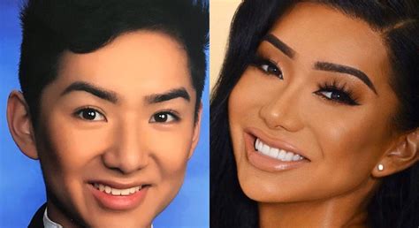 nikita dragun before surgery|Nikita Dragun is Very Open About Her Plastic Surgery Journey